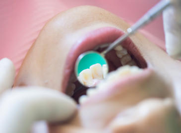 定期検診のイメージ