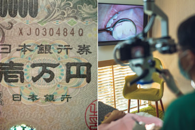 マイクロスコープのイメージ