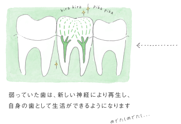 弱っていた歯は、新しい神経により再生し、自身の歯として生活ができるようになります