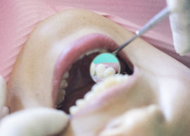 定期検診のイメージ